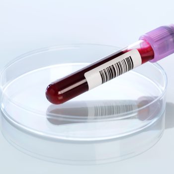Blood sample in petri dish